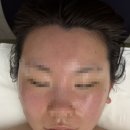 자연피부관리실 | 대구 자연을 닮은 피부관리실 온열뱀부 윤곽관리 받은 후기