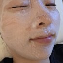 전주 신시가지 효자동 피부관리 라라필 후기! 더글로우 에스테틱