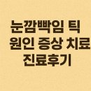 미소진정신건강의학과 | 눈깜빡임 틱 원인 증상 치료 정신건강의학과 진료 후기