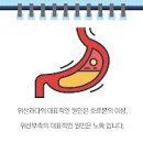 카베진 효능 제산제란 위산과다 원인 카베진 복용시 주의점 이미지