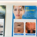 제이콜드