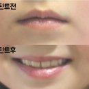 루리앤라라 | 초등학생틴트 !! 코코루리 ! 딸이 좋아해요!!