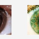 마린안과의원 이미지