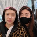 송도 인셀덤 신제품 스노우 엔자임 클렌저 후기보기