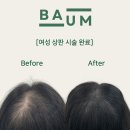 바움SMP