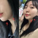 상도코아루센트럴하임경로당 | 포항 리프팅 매끄롬 하이푸 V라인 작은얼굴 피부관리