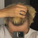 오케이연합의원 | 청주 엠자탈모를 치료할 수 있을까