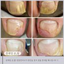 마이네일프랜즈 이미지