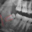 호평나무치과의원 이미지