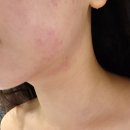 더 빛날 에스테틱 & 왁싱 | [당산 피부관리] 웨딩관리 착붙턱 ‘더 빛날 에스테틱&왁싱 솔직후기