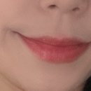 톤즈의원인천 네이버블로그