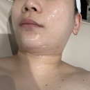 미사강변동로 | 하남 미사역 리프팅 1회만으로 즉각적인 효과 나타난 앙팡 에스테틱 1-2회차 후기
