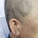 전주벨톤보청기 이미지