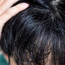 흰머리, 몸이 암을 막은 흔적일수도 있다 이미지