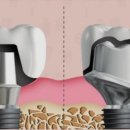 정도치과기공소 이미지