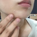 진메디케어 이미지