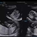 해피맘산부인과의원 이미지