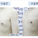 영광비뇨기과의원 | 여유증수술병원, 17년간 2800건 수술해온 비결