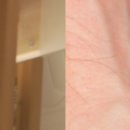 참든든한마취통증의학과의원 | 대구정형외과추천 체외충격파 치료로 비수술 통증치료