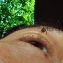 벌레의 눈 렌즈 이미지