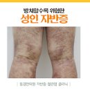 성인과 소아의 자반증 원인 및 증상과 치료 방법 : 다리에 붉은 반점?! 이미지