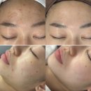 남구-111 | 울산 남구 피부관리 잘하는 곳 결에스테틱