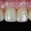 정석치과기공소 이미지