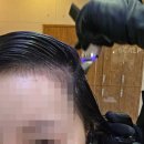 씨유내곡6단지점 | 구로 두피관리 네오나오 두피관리 구로디지털단지역 시술정보 가격