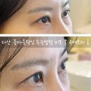 올아웃왁싱