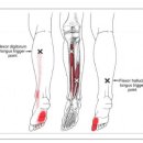 Flexor Digitorum Longus (장무지굴근) 이미지