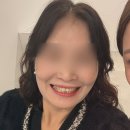 라미갤러리 | 비뚤어진 치아 콤플렉스 탈출한 라미글로우 라미네이트 후기