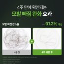 여름샴푸 지성두피샴푸추천 모근활력 및 탈모증상완화 세레미샴푸 사용후기