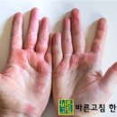 세제한의원 네이버블로그