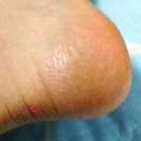 케이더마 이미지