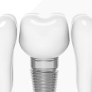 넥스트치과의원 이미지