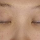 인트로성형외과의원 이미지