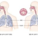 노래 잘하는 법 보컬 트레이닝 이미지
