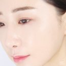 베쏘네일