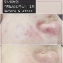 선 피부샵