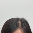 오하이스칼프