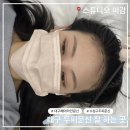 아담헤어스튜디오 | 대구두피문신잘하는곳 헤어라인 문신 후기 수성구 ‘스튜디오미감’(+리터치)