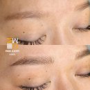 미우대구피우다뷰티 이미지