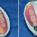 웰치과기공소 이미지