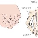 비발란스