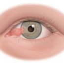 부천안과의원 이미지