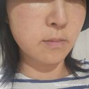 예서한의원 | [강남역 리프팅 피부과] 미백관리 피부관리는 여기서