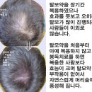 허망한 탈모치료제 ~~원망스런 탈모약 이미지