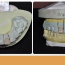 율치과기공소 이미지