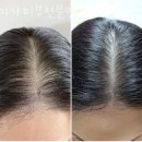 미가피부전문연구소 네이버블로그