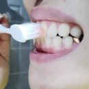 덴티스플러스 이미지